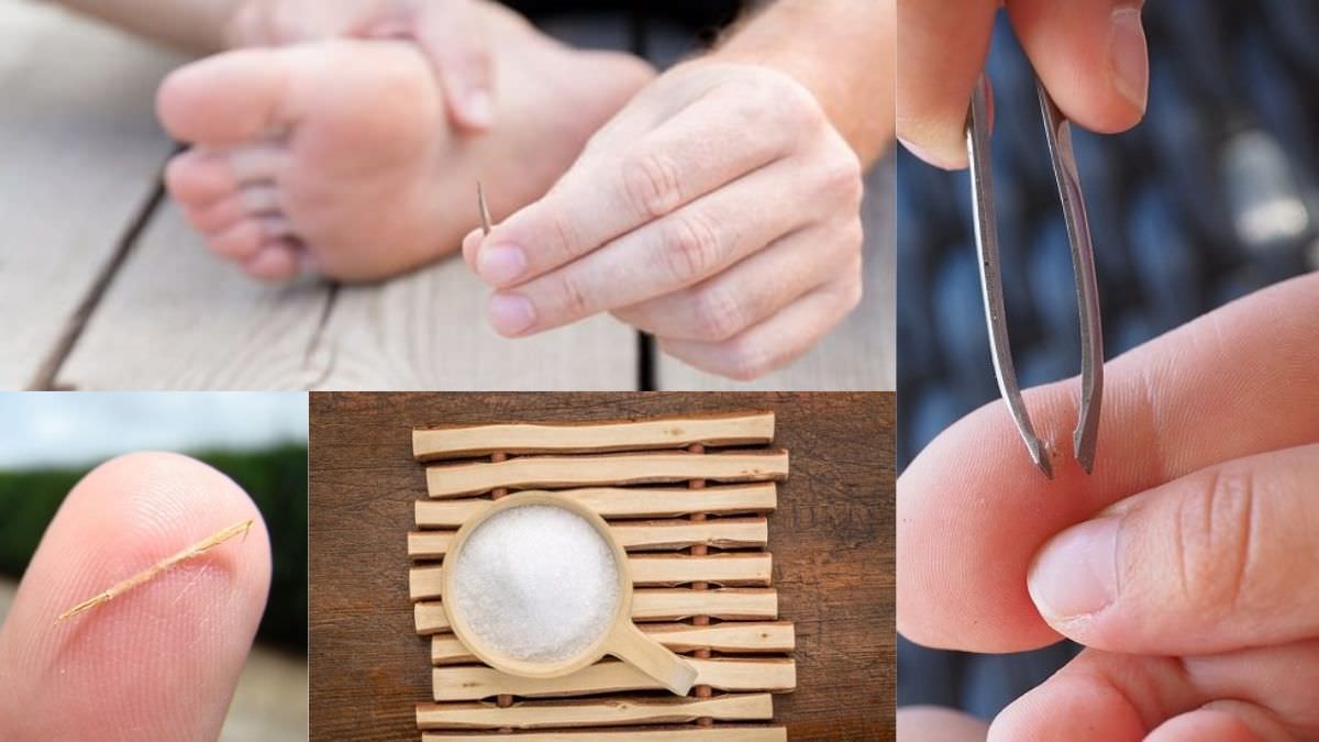 How to remove a deep splinter with Epsom salt? ⋆ The Health Exchange